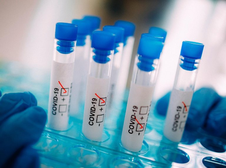 Covid-19 | Diagnosticados 383 casos nos Açores nas últimas 24 horas