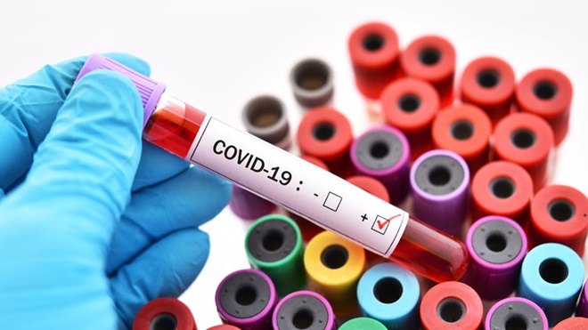 Covid-19 | Açores com 1.153 novos casos e 12.185 infeções ativas